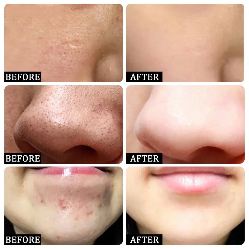 Salicylic Acid Pore Clearing C - مراجعة Korean Skincare Routine وسعره