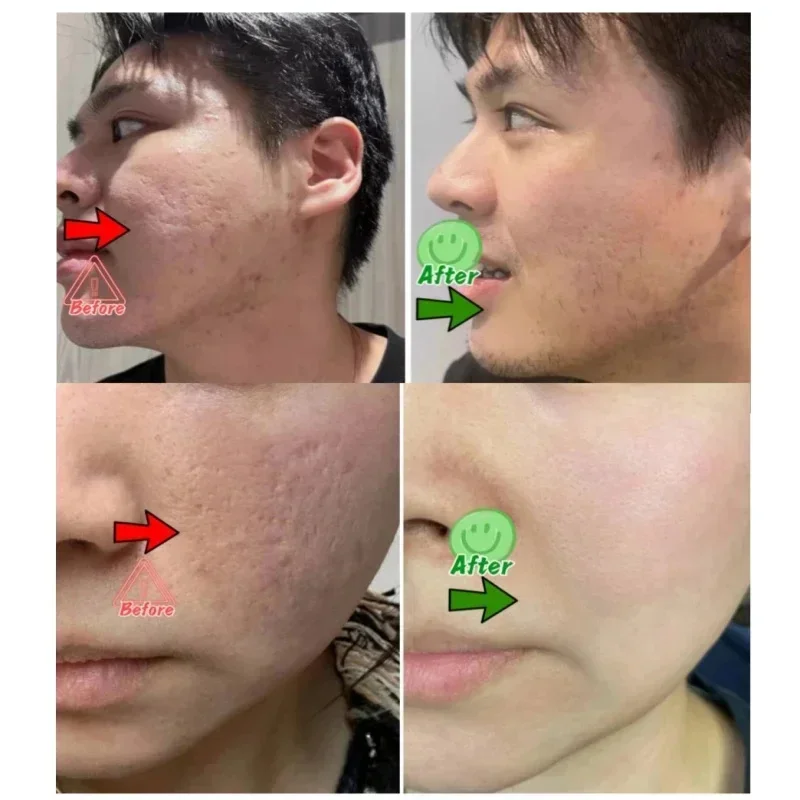 Salicylic Acid Pore Clearing C - مراجعة Korean Skincare Routine وسعره