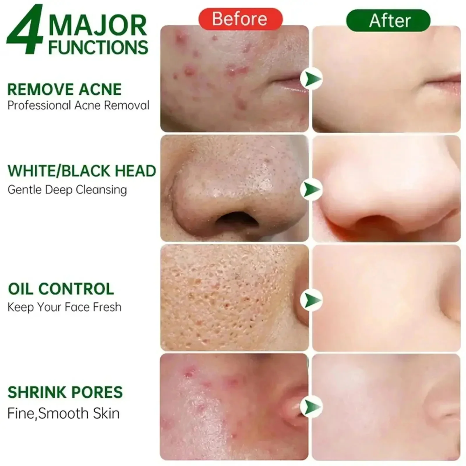 Salicylic Acid Pore Clearing C - مراجعة Korean Skincare Routine وسعره
