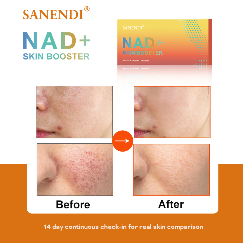 Sanendi NAD+ Korea Skincare Pr - مراجعة Korean Skincare Routine وسعره